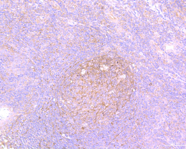 Immunohistochemical analysis of paraffin-embedded human tonsil tissue using anti-Survivin antibody. The section was pre-treated using heat mediated antigen retrieval with Tris-EDTA buffer (pH 8.0-8.4) for 20 minutes.The tissues were blocked in 5% BSA for 30 minutes at room temperature, washed with ddH2O and PBS, and then probed with the primary antibody (ET1604-34, 1/50) for 30 minutes at room temperature. The detection was performed using an HRP conjugated compact polymer system. DAB was used as the chromogen. Tissues were counterstained with hematoxylin and mounted with DPX.