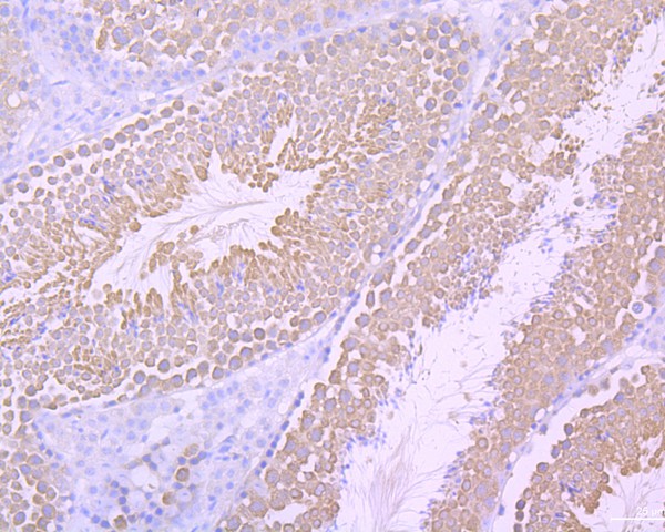 Immunohistochemical analysis of paraffin-embedded mouse testis tissue using anti-Survivin antibody. The section was pre-treated using heat mediated antigen retrieval with Tris-EDTA buffer (pH 8.0-8.4) for 20 minutes.The tissues were blocked in 5% BSA for 30 minutes at room temperature, washed with ddH2O and PBS, and then probed with the primary antibody (ET1604-34, 1/50) for 30 minutes at room temperature. The detection was performed using an HRP conjugated compact polymer system. DAB was used as the chromogen. Tissues were counterstained with hematoxylin and mounted with DPX.