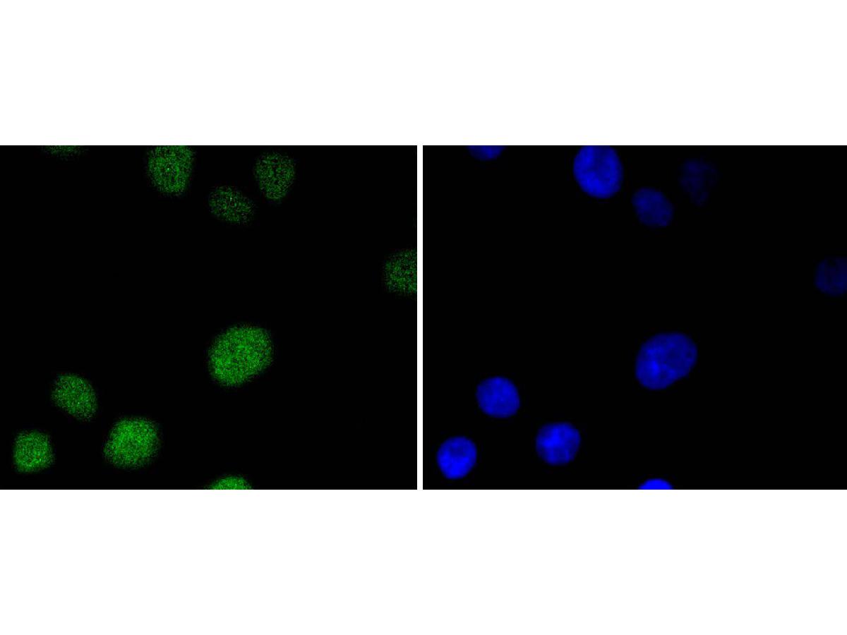 ICC staining of MSH6 in A549 cells (green). Formalin fixed cells were permeabilized with 0.1% Triton X-100 in TBS for 10 minutes at room temperature and blocked with 1% Blocker BSA for 15 minutes at room temperature. Cells were probed with the primary antibody (ET1604-39, 1/50) for 1 hour at room temperature, washed with PBS. Alexa Fluor®488 Goat anti-Rabbit IgG was used as the secondary antibody at 1/1,000 dilution. The nuclear counter stain is DAPI (blue).