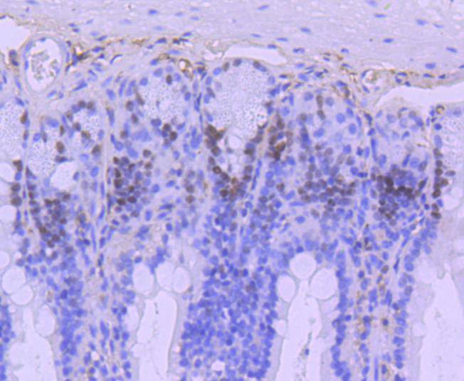 Immunohistochemical analysis of paraffin-embedded mouse colon tissue using anti-MSH6 antibody. The section was pre-treated using heat mediated antigen retrieval with Tris-EDTA buffer (pH 8.0-8.4) for 20 minutes.The tissues were blocked in 5% BSA for 30 minutes at room temperature, washed with ddH2O and PBS, and then probed with the primary antibody (ET1604-39, 1/50) for 30 minutes at room temperature. The detection was performed using an HRP conjugated compact polymer system. DAB was used as the chromogen. Tissues were counterstained with hematoxylin and mounted with DPX.