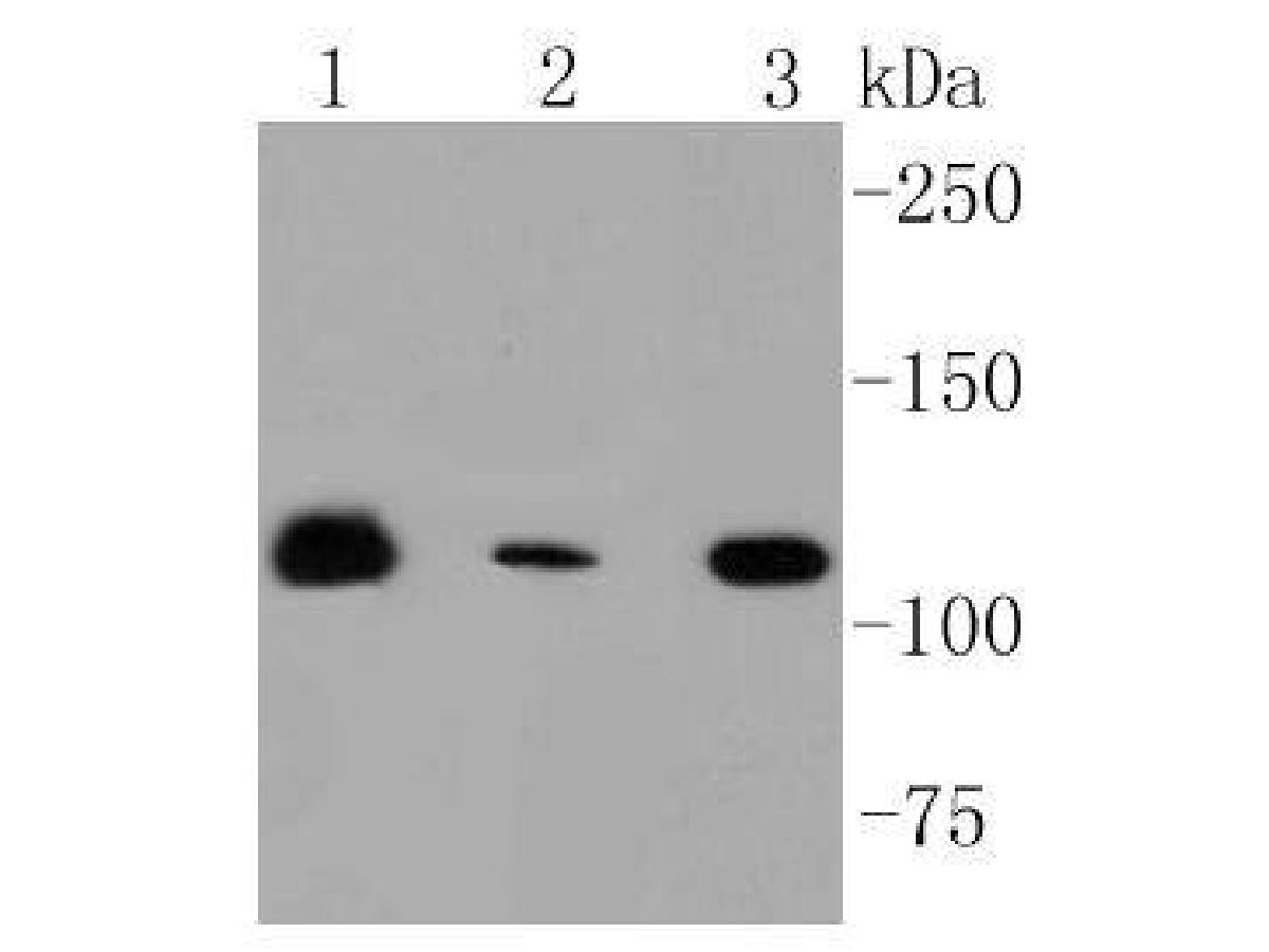 Western blot analysis of RNF20 on different lysates using anti-RNF20 antibody(ET1604-4) at 1/1,000 dilution.<br />
Positive control:   <br />
Lane 1: Hela cell lysate           <br />
Lane 2: MCF-7 cell lysate<br />
Lane 3: Jurkat cell lysate