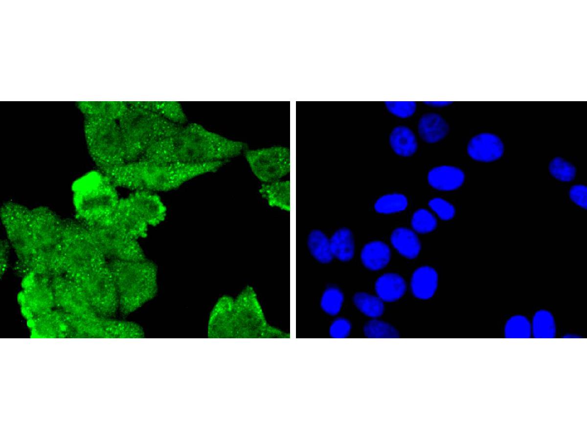 ICC staining of MLH1 in HepG2 cells (green). Formalin fixed cells were permeabilized with 0.1% Triton X-100 in TBS for 10 minutes at room temperature and blocked with 1% Blocker BSA for 15 minutes at room temperature. Cells were probed with the primary antibody (ET1604-41, 1/50) for 1 hour at room temperature, washed with PBS. Alexa Fluor®488 Goat anti-Rabbit IgG was used as the secondary antibody at 1/1,000 dilution. The nuclear counter stain is DAPI (blue).