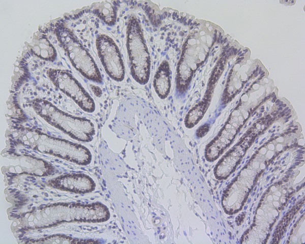Immunohistochemical analysis of paraffin-embedded rat large intestine tissue using anti-MLH1 antibody. The section was pre-treated using heat mediated antigen retrieval with Tris-EDTA buffer (pH 8.0-8.4) for 20 minutes.The tissues were blocked in 5% BSA for 30 minutes at room temperature, washed with ddH2O and PBS, and then probed with the primary antibody (ET1604-41, 1/200) for 30 minutes at room temperature. The detection was performed using an HRP conjugated compact polymer system. DAB was used as the chromogen. Tissues were counterstained with hematoxylin and mounted with DPX.