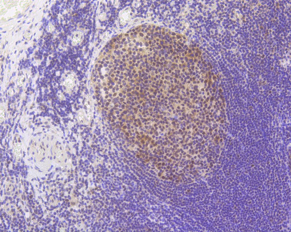 Immunohistochemical analysis of paraffin-embedded human tonsil tissue using anti-MLH1 antibody. The section was pre-treated using heat mediated antigen retrieval with Tris-EDTA buffer (pH 8.0-8.4) for 20 minutes.The tissues were blocked in 5% BSA for 30 minutes at room temperature, washed with ddH2O and PBS, and then probed with the primary antibody (ET1604-41, 1/200) for 30 minutes at room temperature. The detection was performed using an HRP conjugated compact polymer system. DAB was used as the chromogen. Tissues were counterstained with hematoxylin and mounted with DPX.
