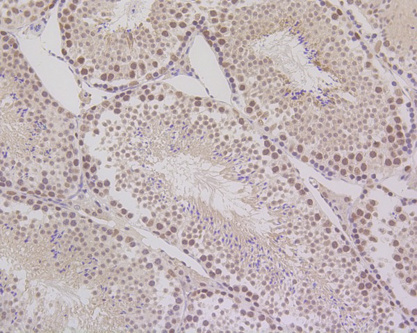Immunohistochemical analysis of paraffin-embedded mouse testis tissue using anti-MLH1 antibody. The section was pre-treated using heat mediated antigen retrieval with Tris-EDTA buffer (pH 8.0-8.4) for 20 minutes.The tissues were blocked in 5% BSA for 30 minutes at room temperature, washed with ddH2O and PBS, and then probed with the primary antibody (ET1604-41, 1/200) for 30 minutes at room temperature. The detection was performed using an HRP conjugated compact polymer system. DAB was used as the chromogen. Tissues were counterstained with hematoxylin and mounted with DPX.