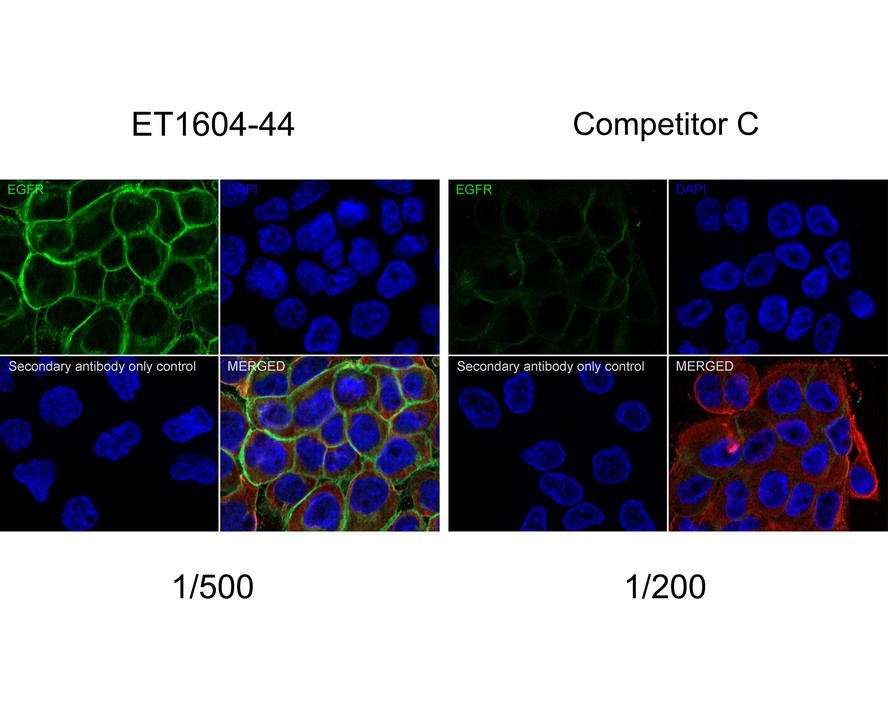 Immunocytochemistry analysis of A431 cells labeling EGFR with Rabbit anti-EGFR antibody (ET1604-44) at 1/500 dilution and competitor's antibody at 1/200 dilution.<br />
<br />
Cells were fixed in 4% paraformaldehyde for 20 minutes at room temperature, permeabilized with 0.1% Triton X-100 in PBS for 5 minutes at room temperature, then blocked with 1% BSA in 10% negative goat serum for 1 hour at room temperature. Cells were then incubated with Rabbit anti-EGFR antibody (ET1604-44) at 1/500 dilution and competitor's antibody at 1/200 dilution in 1% BSA in PBST overnight at 4 ℃. Goat Anti-Rabbit IgG H&L (iFluor™ 488, HA1121) was used as the secondary antibody at 1/1,000 dilution. PBS instead of the primary antibody was used as the secondary antibody only control. Nuclear DNA was labelled in blue with DAPI.<br />
<br />
Beta tubulin (M1305-2, red) was stained at 1/100 dilution overnight at +4℃. Goat Anti-Mouse IgG H&L (iFluor™ 594, HA1126) was used as the secondary antibody at 1/1,000 dilution.