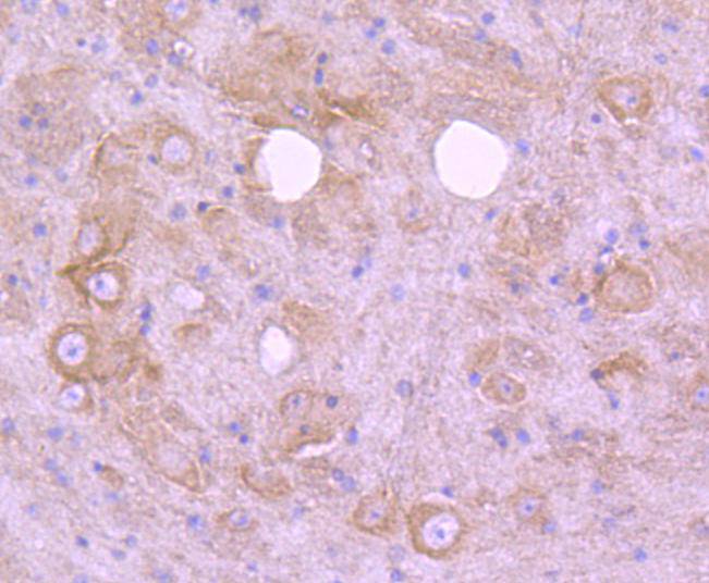 Immunohistochemical analysis of paraffin-embedded mouse brain tissue using anti-EGFR antibody. The section was pre-treated using heat mediated antigen retrieval with Tris-EDTA buffer (pH 8.0-8.4) for 20 minutes.The tissues were blocked in 5% BSA for 30 minutes at room temperature, washed with ddH2O and PBS, and then probed with the primary antibody (ET1604-44, 1/50) for 30 minutes at room temperature. The detection was performed using an HRP conjugated compact polymer system. DAB was used as the chromogen. Tissues were counterstained with hematoxylin and mounted with DPX.