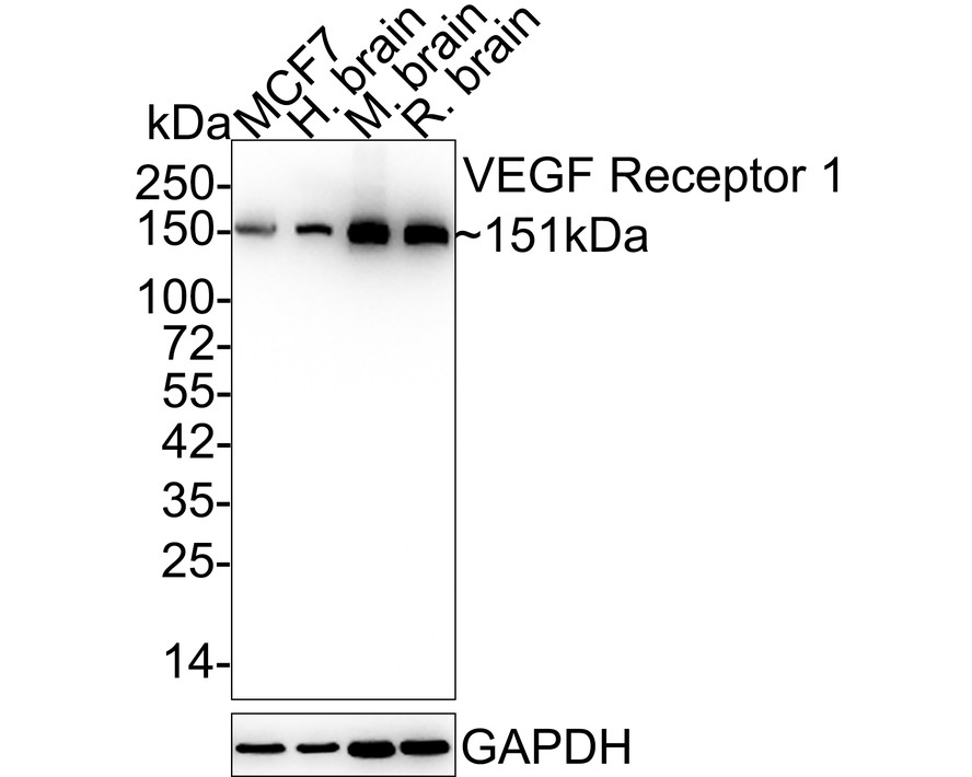 Western blot analysis of VEGF Receptor 1 on mouse lung tissue lysates. Proteins were transferred to a PVDF membrane and blocked with 5% BSA in PBS for 1 hour at room temperature. The primary antibody (ET1605-11, 1/500) was used in 5% BSA at room temperature for 2 hours. Goat Anti-Rabbit IgG - HRP Secondary Antibody (HA1001) at 1:200,000 dilution was used for 1 hour at room temperature.