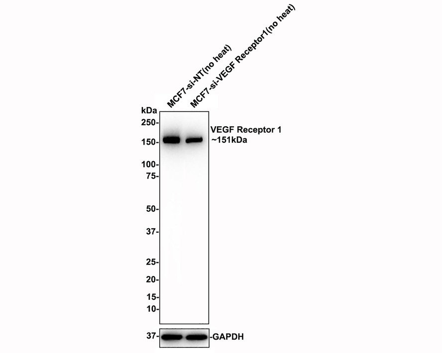 Western blot analysis of VEGF Receptor 1 on HUVEC cell lysates. Proteins were transferred to a PVDF membrane and blocked with 5% BSA in PBS for 1 hour at room temperature. The primary antibody (ET1605-11, 1/500) was used in 5% BSA at room temperature for 2 hours. Goat Anti-Rabbit IgG - HRP Secondary Antibody (HA1001) at 1:200,000 dilution was used for 1 hour at room temperature.
