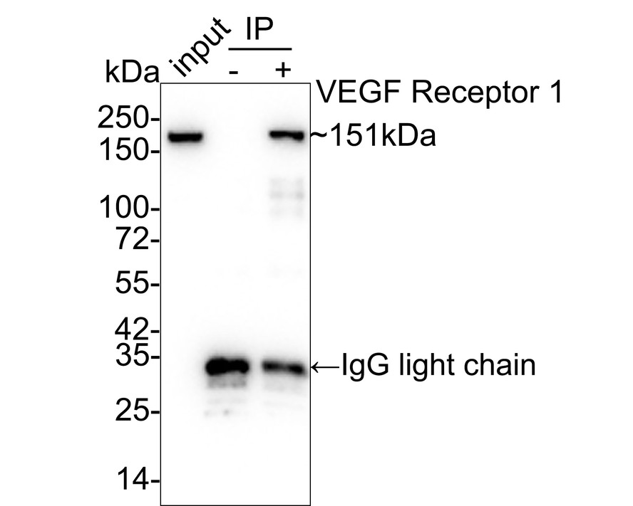 ICC staining of VEGF Receptor 1 in N2A cells (green). Formalin fixed cells were permeabilized with 0.1% Triton X-100 in TBS for 10 minutes at room temperature and blocked with 10% negative goat serum for 15 minutes at room temperature. Cells were probed with the primary antibody (ET1605-11, 1/50) for 1 hour at room temperature, washed with PBS. Alexa Fluor®488 conjugate-Goat anti-Rabbit IgG was used as the secondary antibody at 1/1,000 dilution. The nuclear counter stain is DAPI (blue).