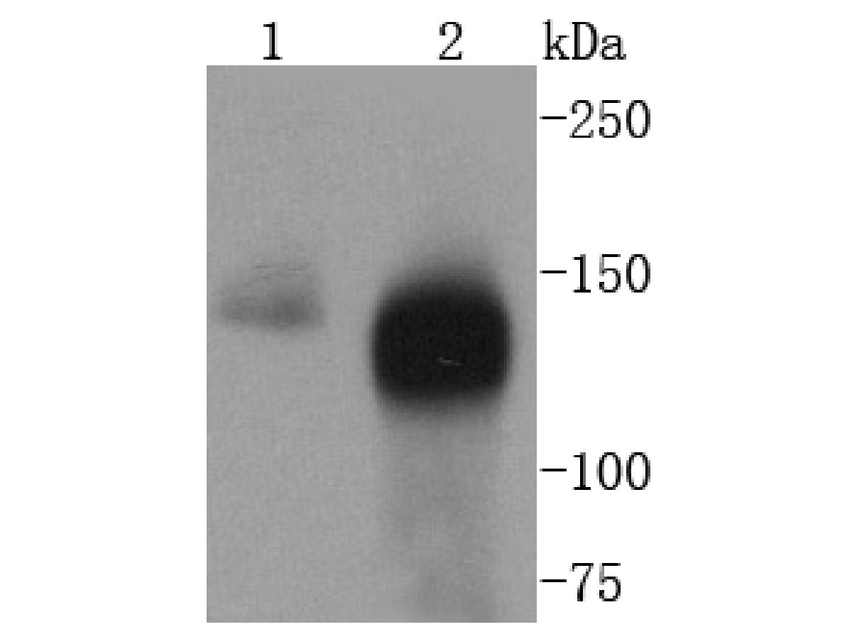 Western blot analysis of TACC3 on different lysates with Rabbit anti-TACC3 antibody (ET1605-18) at 1/500 dilution.<br />
<br />
Lane 1: HT29 cell lysates<br />
Lane 2: Hela cell lysates<br />
<br />
Lysates/proteins at 10 µg/Lane.<br />
<br />
Predicted band size: 90 kDa<br />
Observed band size: 140 kDa<br />
<br />
Exposure time: 2 minutes;<br />
<br />
6% SDS-PAGE gel.<br />
<br />
Proteins were transferred to a PVDF membrane and blocked with 5% NFDM/TBST for 1 hour at room temperature. The primary antibody (ET1605-18) at 1/500 dilution was used in 5% NFDM/TBST at room temperature for 2 hours. Goat Anti-Rabbit IgG - HRP Secondary Antibody (HA1001) at 1:300,000 dilution was used for 1 hour at room temperature.