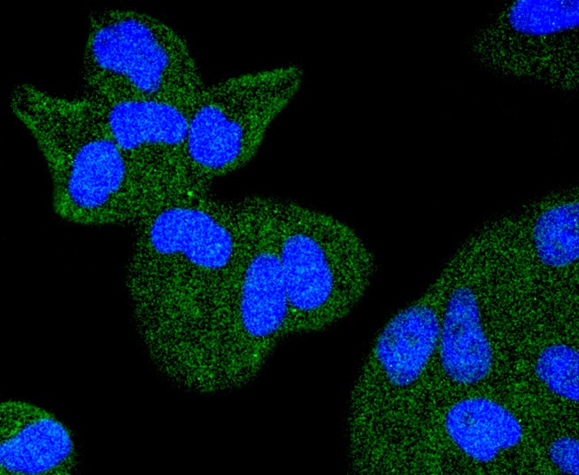 ICC staining TACC3 in Hela cells (green). The nuclear counter stain is DAPI (blue). Cells were fixed in paraformaldehyde, permeabilised with 0.25% Triton X100/PBS.