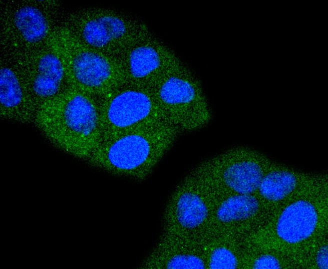 ICC staining TACC3 in HepG2 cells (green). The nuclear counter stain is DAPI (blue). Cells were fixed in paraformaldehyde, permeabilised with 0.25% Triton X100/PBS.