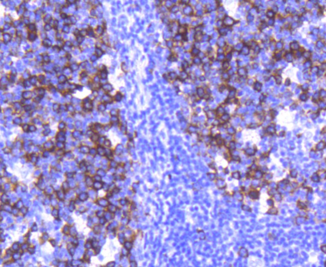Immunohistochemical analysis of paraffin-embedded human tonsil tissue using anti-TACC3 antibody. Counter stained with hematoxylin.