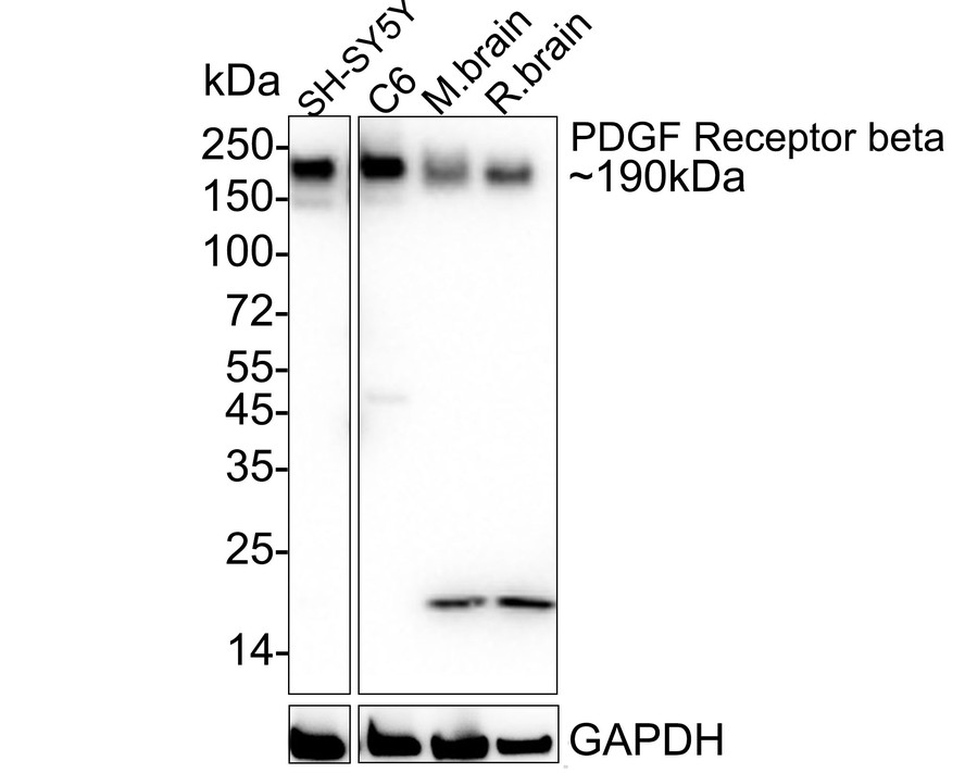 Western blot analysis of PDGF Receptor beta on NIH/3T3 cell lysates. Proteins were transferred to a PVDF membrane and blocked with 5% BSA in PBS for 1 hour at room temperature. The primary antibody (ET1605-20, 1/500) was used in 5% BSA at room temperature for 2 hours. Goat Anti-Rabbit IgG - HRP Secondary Antibody (HA1001) at 1:200,000 dilution was used for 1 hour at room temperature.<br />
<br />
Predicted band size: 124 kDa<br />
Observed band size: 170 kDa