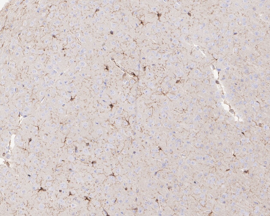 Immunohistochemical analysis of paraffin-embedded human spleen tissue using anti-PDGF Receptor beta antibody. The section was pre-treated using heat mediated antigen retrieval with Tris-EDTA buffer (pH 9.0) for 20 minutes.The tissues were blocked in 1% BSA for 30 minutes at room temperature, washed with ddH2O and PBS, and then probed with the primary antibody (ET1605-20, 1/50) for 30 minutes at room temperature. The detection was performed using an HRP conjugated compact polymer system. DAB was used as the chromogen. Tissues were counterstained with hematoxylin and mounted with DPX.