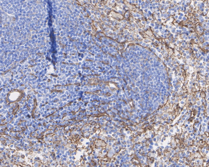 Immunohistochemical analysis of paraffin-embedded mouse lung tissue using anti-PDGF Receptor beta antibody. The section was pre-treated using heat mediated antigen retrieval with Tris-EDTA buffer (pH 9.0) for 20 minutes.The tissues were blocked in 1% BSA for 30 minutes at room temperature, washed with ddH2O and PBS, and then probed with the primary antibody (ET1605-20, 1/50) for 30 minutes at room temperature. The detection was performed using an HRP conjugated compact polymer system. DAB was used as the chromogen. Tissues were counterstained with hematoxylin and mounted with DPX.