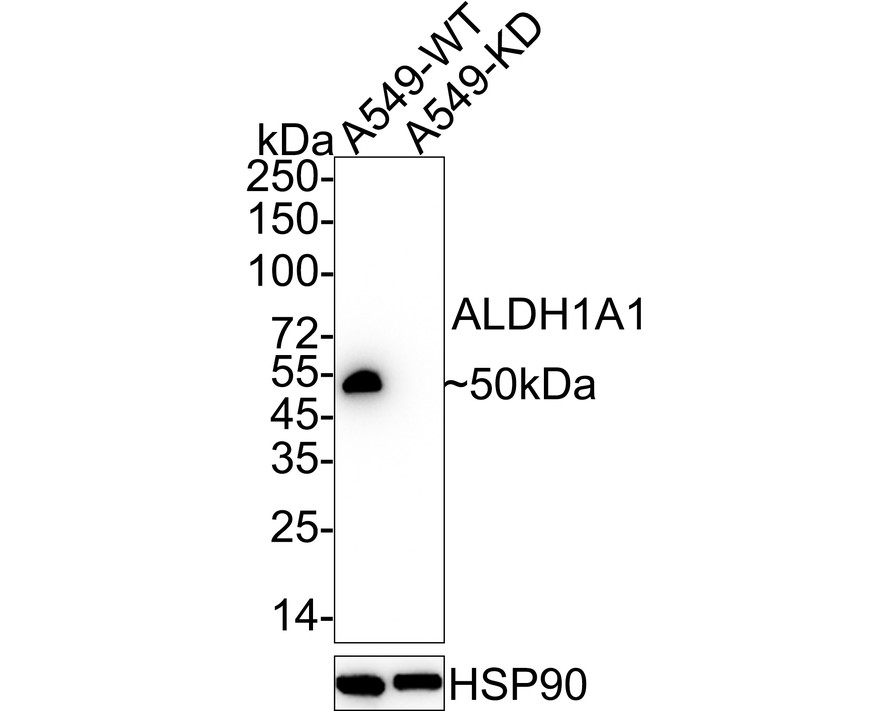 Western blot analysis of ALDH1A1 on different lysates. Proteins were transferred to a PVDF membrane and blocked with 5% BSA in PBS for 1 hour at room temperature. The primary antibody (ET1605-24, 1/500) was used in 5% BSA at room temperature for 2 hours. Goat Anti-Rabbit IgG - HRP Secondary Antibody (HA1001) at 1:5,000 dilution was used for 1 hour at room temperature.<br />
Positive control: <br />
Lane 1: mouse lung tissue lysate<br />
Lane 2: human liver tissue lysate<br />
Lane 3: human kidney tissue lysate