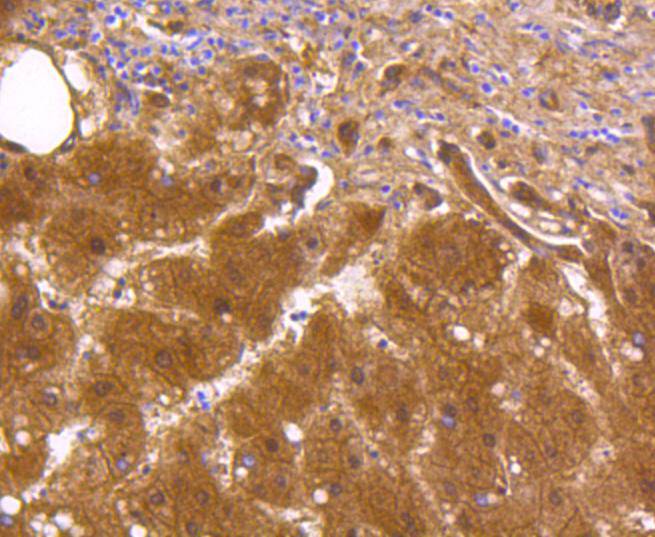 Immunohistochemical analysis of paraffin-embedded human kidney tissue using anti-ALDH1A1 antibody. The section was pre-treated using heat mediated antigen retrieval with Tris-EDTA buffer (pH 8.0-8.4) for 20 minutes.The tissues were blocked in 5% BSA for 30 minutes at room temperature, washed with ddH2O and PBS, and then probed with the primary antibody (ET1605-24, 1/200) for 30 minutes at room temperature. The detection was performed using an HRP conjugated compact polymer system. DAB was used as the chromogen. Tissues were counterstained with hematoxylin and mounted with DPX.