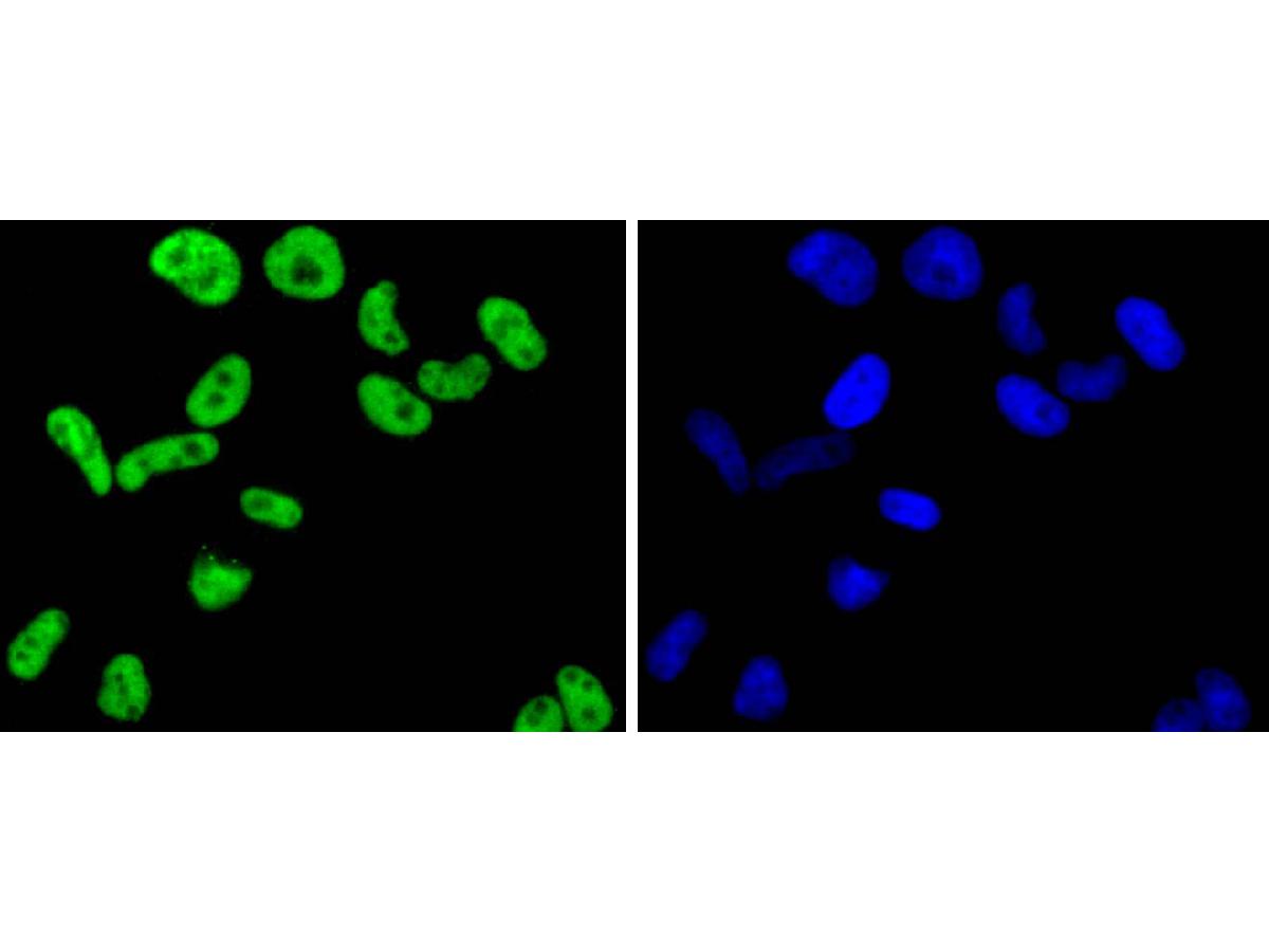 ICC staining of FUBP1 in Hela cells (green). Formalin fixed cells were permeabilized with 0.1% Triton X-100 in TBS for 10 minutes at room temperature and blocked with 10% negative goat serum for 15 minutes at room temperature. Cells were probed with the primary antibody (ET1605-26, 1/50) for 1 hour at room temperature, washed with PBS. Alexa Fluor®488 conjugate-Goat anti-Rabbit IgG was used as the secondary antibody at 1/1,000 dilution. The nuclear counter stain is DAPI (blue).