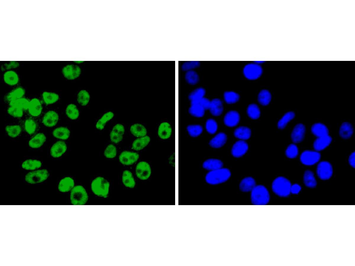 ICC staining of FUBP1 in MCF-7 cells (green). Formalin fixed cells were permeabilized with 0.1% Triton X-100 in TBS for 10 minutes at room temperature and blocked with 10% negative goat serum for 15 minutes at room temperature. Cells were probed with the primary antibody (ET1605-26, 1/50) for 1 hour at room temperature, washed with PBS. Alexa Fluor®488 conjugate-Goat anti-Rabbit IgG was used as the secondary antibody at 1/1,000 dilution. The nuclear counter stain is DAPI (blue).