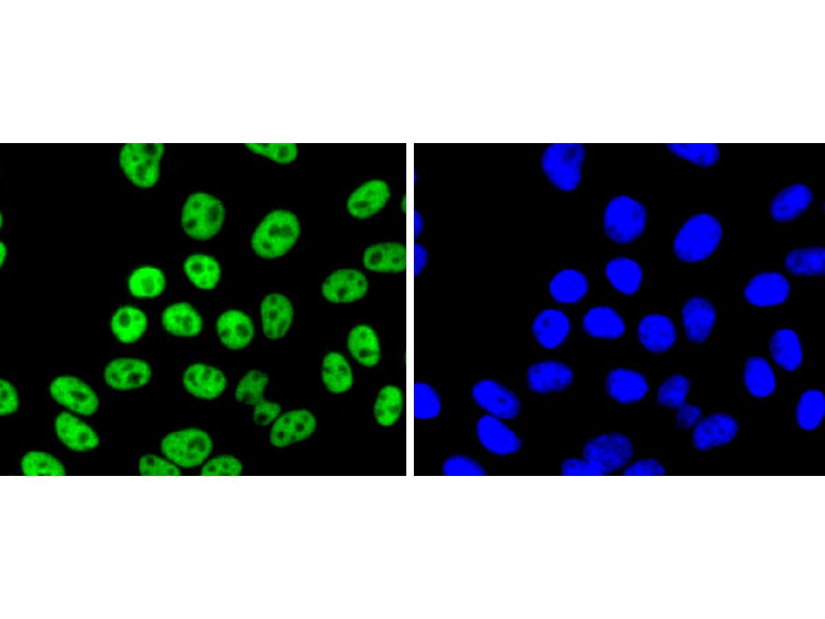 ICC staining of FUBP1 in HepG2 cells (green). Formalin fixed cells were permeabilized with 0.1% Triton X-100 in TBS for 10 minutes at room temperature and blocked with 10% negative goat serum for 15 minutes at room temperature. Cells were probed with the primary antibody (ET1605-26, 1/50) for 1 hour at room temperature, washed with PBS. Alexa Fluor®488 conjugate-Goat anti-Rabbit IgG was used as the secondary antibody at 1/1,000 dilution. The nuclear counter stain is DAPI (blue).