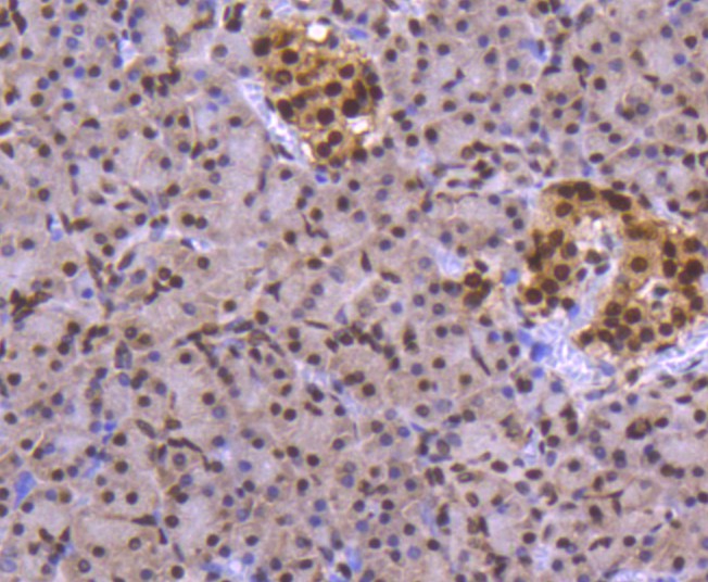 Immunohistochemical analysis of paraffin-embedded human pancreas tissue using anti-FUBP1 antibody. The section was pre-treated using heat mediated antigen retrieval with Tris-EDTA buffer (pH 9.0) for 20 minutes.The tissues were blocked in 1% BSA for 30 minutes at room temperature, washed with ddH2O and PBS, and then probed with the primary antibody (ET1605-26, 1/50) for 30 minutes at room temperature. The detection was performed using an HRP conjugated compact polymer system. DAB was used as the chromogen. Tissues were counterstained with hematoxylin and mounted with DPX.