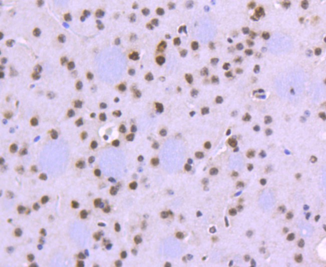 Immunohistochemical analysis of paraffin-embedded mouse brain tissue using anti-FUBP1 antibody. The section was pre-treated using heat mediated antigen retrieval with Tris-EDTA buffer (pH 9.0) for 20 minutes.The tissues were blocked in 1% BSA for 30 minutes at room temperature, washed with ddH2O and PBS, and then probed with the primary antibody (ET1605-26, 1/50) for 30 minutes at room temperature. The detection was performed using an HRP conjugated compact polymer system. DAB was used as the chromogen. Tissues were counterstained with hematoxylin and mounted with DPX.