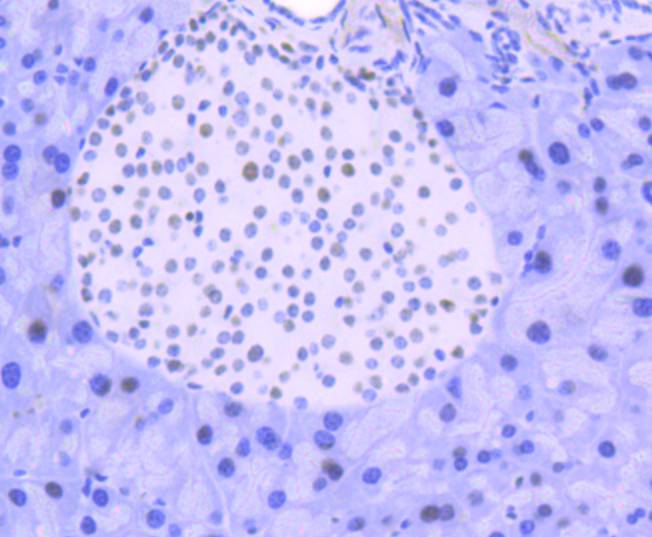 Immunohistochemical analysis of paraffin-embedded mouse pancreas tissue using anti-FUBP1 antibody. The section was pre-treated using heat mediated antigen retrieval with Tris-EDTA buffer (pH 9.0) for 20 minutes.The tissues were blocked in 1% BSA for 30 minutes at room temperature, washed with ddH2O and PBS, and then probed with the primary antibody (ET1605-26, 1/50) for 30 minutes at room temperature. The detection was performed using an HRP conjugated compact polymer system. DAB was used as the chromogen. Tissues were counterstained with hematoxylin and mounted with DPX.