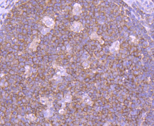 Immunohistochemical analysis of paraffin-embedded human tonsil tissue using anti-SHIP antibody. The section was pre-treated using heat mediated antigen retrieval with Tris-EDTA buffer (pH 8.0-8.4) for 20 minutes.The tissues were blocked in 5% BSA for 30 minutes at room temperature, washed with ddH2O and PBS, and then probed with the primary antibody (ET1605-30, 1/50) for 30 minutes at room temperature. The detection was performed using an HRP conjugated compact polymer system. DAB was used as the chromogen. Tissues were counterstained with hematoxylin and mounted with DPX.