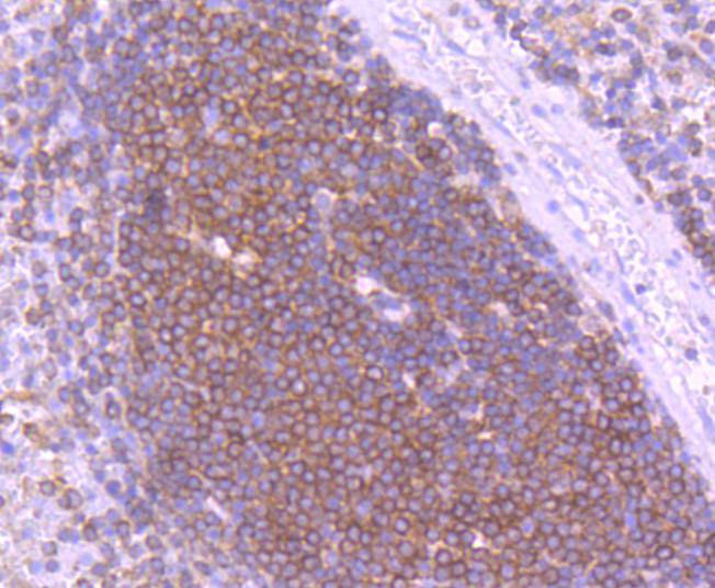 Immunohistochemical analysis of paraffin-embedded human spleen tissue using anti-SHIP antibody. The section was pre-treated using heat mediated antigen retrieval with Tris-EDTA buffer (pH 8.0-8.4) for 20 minutes.The tissues were blocked in 5% BSA for 30 minutes at room temperature, washed with ddH2O and PBS, and then probed with the primary antibody (ET1605-30, 1/50) for 30 minutes at room temperature. The detection was performed using an HRP conjugated compact polymer system. DAB was used as the chromogen. Tissues were counterstained with hematoxylin and mounted with DPX.