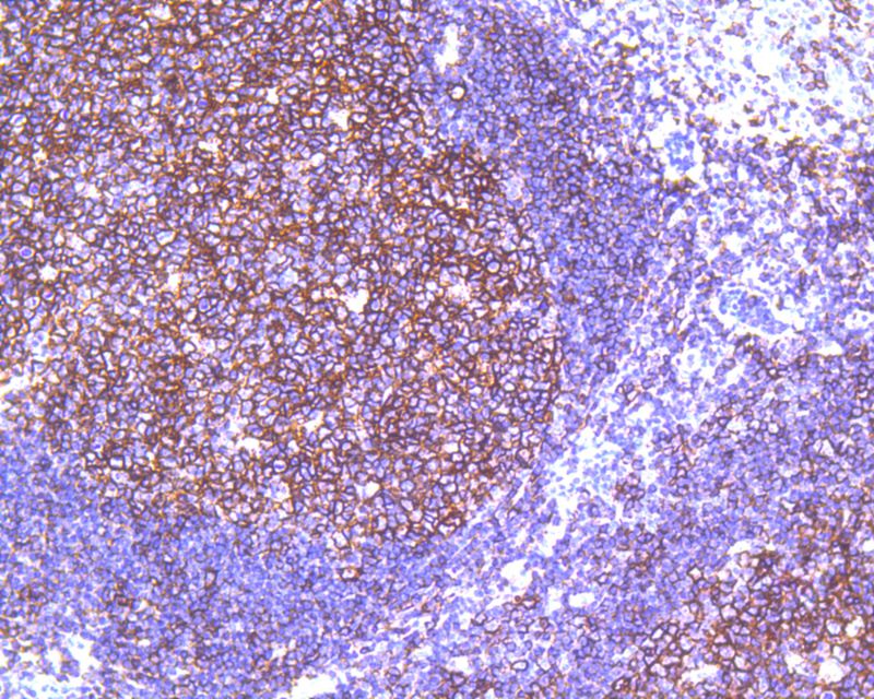 Immunohistochemical analysis of paraffin-embedded human tonsil tissue using anti-CD20 antibody. The section was pre-treated using heat mediated antigen retrieval with Tris-EDTA buffer (pH 8.0-8.4) for 20 minutes.The tissues were blocked in 5% BSA for 30 minutes at room temperature, washed with ddH2O and PBS, and then probed with the primary antibody (ET1605-33, 1/200) for 30 minutes at room temperature. The detection was performed using an HRP conjugated compact polymer system. DAB was used as the chromogen. Tissues were counterstained with hematoxylin and mounted with DPX.