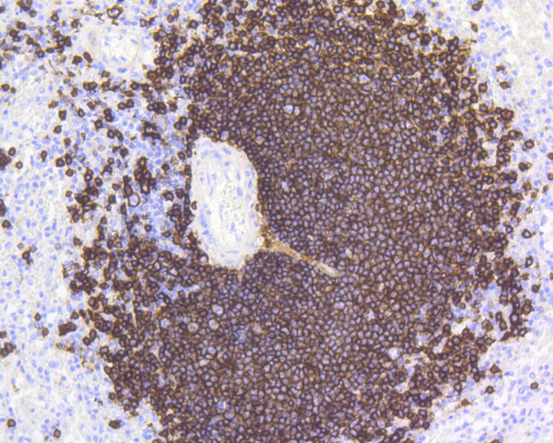 Immunohistochemical analysis of paraffin-embedded human spleen tissue using anti-CD20 antibody. The section was pre-treated using heat mediated antigen retrieval with Tris-EDTA buffer (pH 8.0-8.4) for 20 minutes.The tissues were blocked in 5% BSA for 30 minutes at room temperature, washed with ddH2O and PBS, and then probed with the primary antibody (ET1605-33, 1/200) for 30 minutes at room temperature. The detection was performed using an HRP conjugated compact polymer system. DAB was used as the chromogen. Tissues were counterstained with hematoxylin and mounted with DPX.