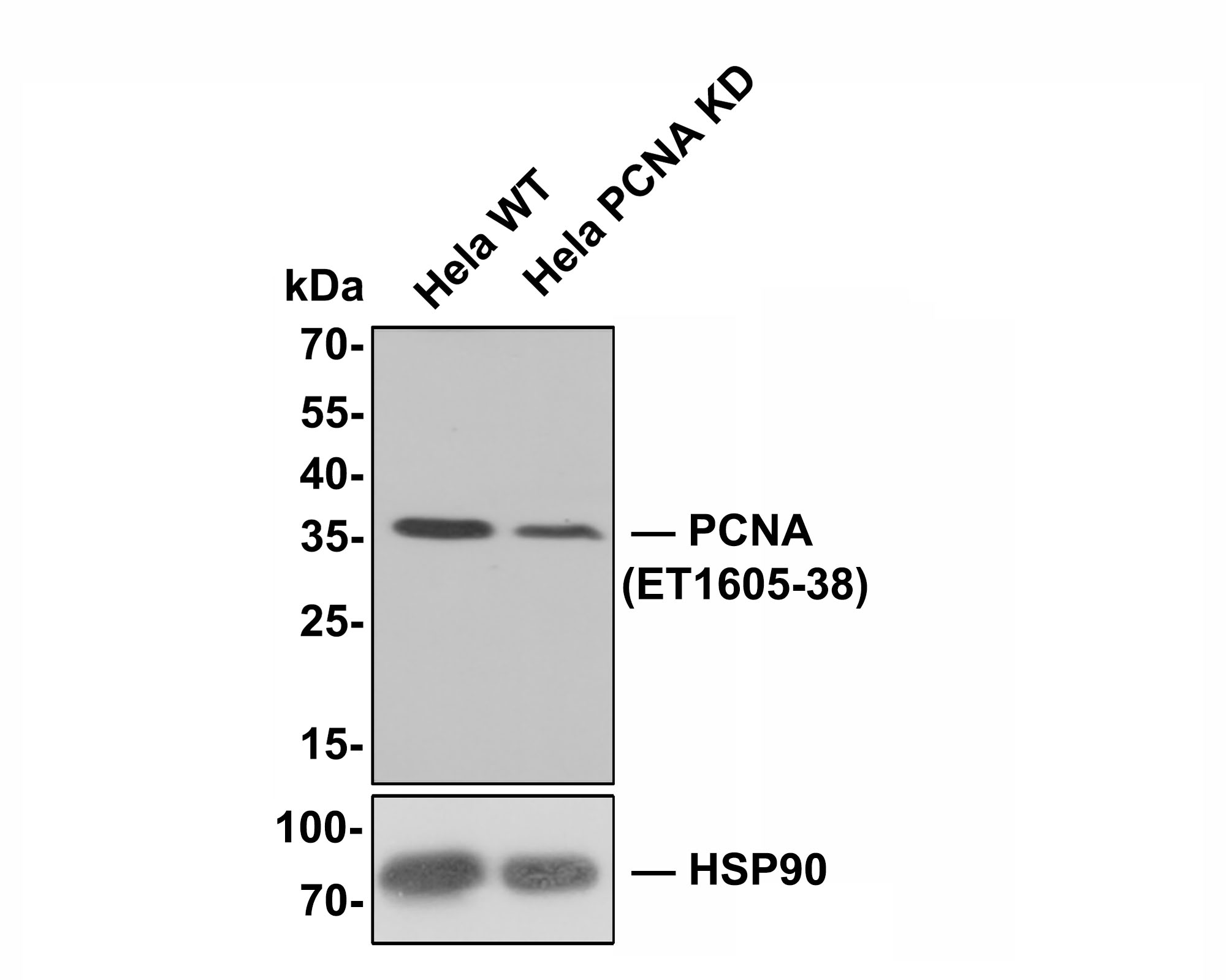 All lanes: Western blot analysis of PCNA with anti-PCNA antibody (ET1605-38) at 1:500 dilution.<br />
Lane 1: Wild-type Hela whole cell lysate (10 µg).<br />
Lane 2/3: PCNA knockdown Hela whole cell lysate (10 µg).<br />
<br />
Predicted band size: 29 kDa<br />
Observed band size: 35 kDa<br />
<br />
ET1605-38 was shown to specifically react with PCNA in wild-type Hela cells. Weakened band was observed when PCNA knockdown sample was tested. Wild-type and PCNA knockdown samples were subjected to SDS-PAGE. Proteins were transferred to a PVDF membrane and blocked with 5% NFDM in TBST for 1 hour at room temperature. The primary antibody (ET1605-38, 1:500) was used in 5% BSA at room temperature for 2 hours. Goat Anti-Rabbit IgG-HRP Secondary Antibody (HA1001) at 1:200,000 dilution was used for 1 hour at room temperature.