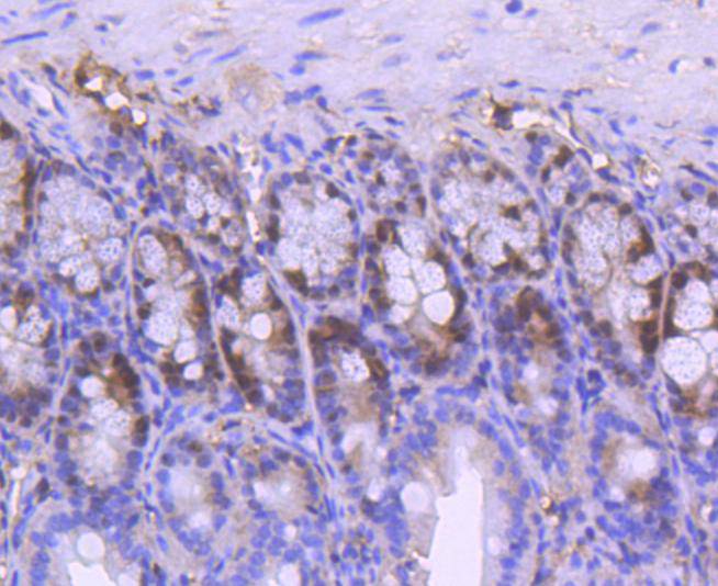 Immunohistochemical analysis of paraffin-embedded mouse spleen tissue using anti-PCNA antibody. The section was pre-treated using heat mediated antigen retrieval with Tris-EDTA buffer (pH 8.0-8.4) for 20 minutes.The tissues were blocked in 5% BSA for 30 minutes at room temperature, washed with ddH2O and PBS, and then probed with the primary antibody (ET1605-38, 1/50) for 30 minutes at room temperature. The detection was performed using an HRP conjugated compact polymer system. DAB was used as the chromogen. Tissues were counterstained with hematoxylin and mounted with DPX.