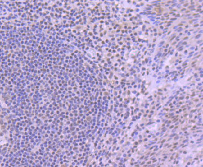 Immunohistochemical analysis of paraffin-embedded human tonsil tissue using anti-YY1 antibody. The section was pre-treated using heat mediated antigen retrieval with Tris-EDTA buffer (pH 8.0-8.4) for 20 minutes.The tissues were blocked in 5% BSA for 30 minutes at room temperature, washed with ddH2O and PBS, and then probed with the primary antibody (ET1605-40, 1/50) for 30 minutes at room temperature. The detection was performed using an HRP conjugated compact polymer system. DAB was used as the chromogen. Tissues were counterstained with hematoxylin and mounted with DPX.