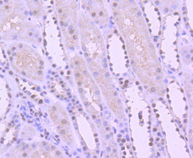 Immunohistochemical analysis of paraffin-embedded human kidney tissue using anti-YY1 antibody. The section was pre-treated using heat mediated antigen retrieval with Tris-EDTA buffer (pH 8.0-8.4) for 20 minutes.The tissues were blocked in 5% BSA for 30 minutes at room temperature, washed with ddH2O and PBS, and then probed with the primary antibody (ET1605-40, 1/50) for 30 minutes at room temperature. The detection was performed using an HRP conjugated compact polymer system. DAB was used as the chromogen. Tissues were counterstained with hematoxylin and mounted with DPX.