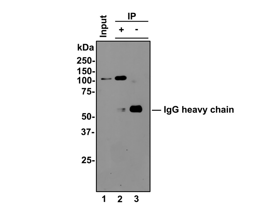 Western blot analysis of STAT6 on different lysates. Proteins were transferred to a PVDF membrane and blocked with 5% BSA in PBS for 1 hour at room temperature. The primary antibody (ET1605-49, 1/500) was used in 5% BSA at room temperature for 2 hours. Goat Anti-Rabbit IgG - HRP Secondary Antibody (HA1001) at 1:200,000 dilution was used for 1 hour at room temperature.<br />
<br />
Positive control: <br />
Lane 1: Raji cell lysate<br />
Lane 2: Daudi cell lysate<br />
<br />
Predicted band size: 94 kDa<br />
Observed band size: 100 kDa