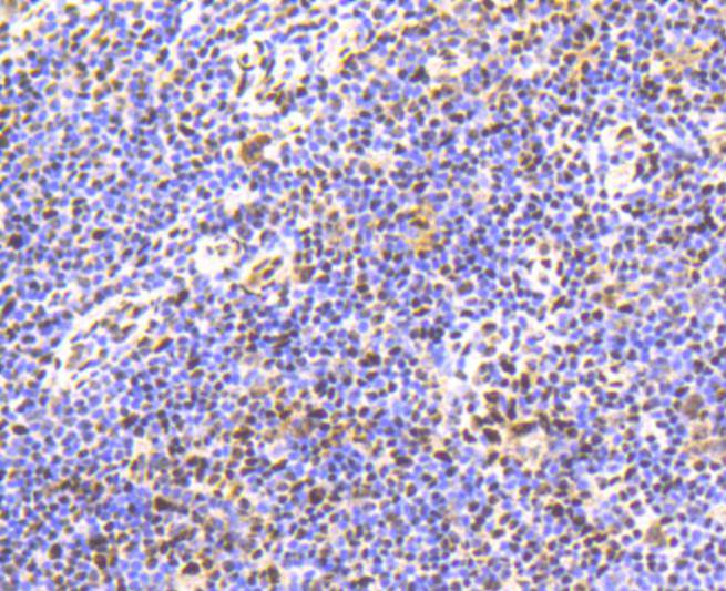 Immunohistochemical analysis of paraffin-embedded human liver tissue using anti-Phospho-Smad5(S463/465) antibody. The section was pre-treated using heat mediated antigen retrieval with Tris-EDTA buffer (pH 8.0-8.4) for 20 minutes.The tissues were blocked in 5% BSA for 30 minutes at room temperature, washed with ddH2O and PBS, and then probed with the primary antibody (ET1605-5, 1/50) for 30 minutes at room temperature. The detection was performed using an HRP conjugated compact polymer system. DAB was used as the chromogen. Tissues were counterstained with hematoxylin and mounted with DPX.