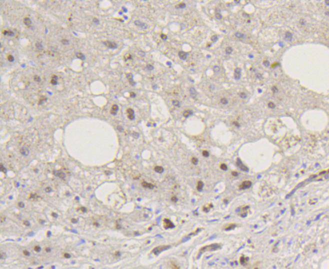 Immunohistochemical analysis of paraffin-embedded mouse brain tissue using anti-Phospho-Smad5(S463/465) antibody. The section was pre-treated using heat mediated antigen retrieval with Tris-EDTA buffer (pH 8.0-8.4) for 20 minutes.The tissues were blocked in 5% BSA for 30 minutes at room temperature, washed with ddH2O and PBS, and then probed with the primary antibody (ET1605-5, 1/50) for 30 minutes at room temperature. The detection was performed using an HRP conjugated compact polymer system. DAB was used as the chromogen. Tissues were counterstained with hematoxylin and mounted with DPX.