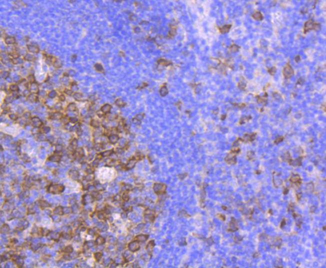 ICC staining of CDK1 in HepG2 cells (red). Formalin fixed cells were permeabilized with 0.1% Triton X-100 in TBS for 10 minutes at room temperature and blocked with 1% Blocker BSA for 15 minutes at room temperature. Cells were probed with the primary antibody (ET1605-54, 1/50) for 1 hour at room temperature, washed with PBS. Alexa Fluor®594 Goat anti-Rabbit IgG was used as the secondary antibody at 1/1,000 dilution. The nuclear counter stain is DAPI (blue).