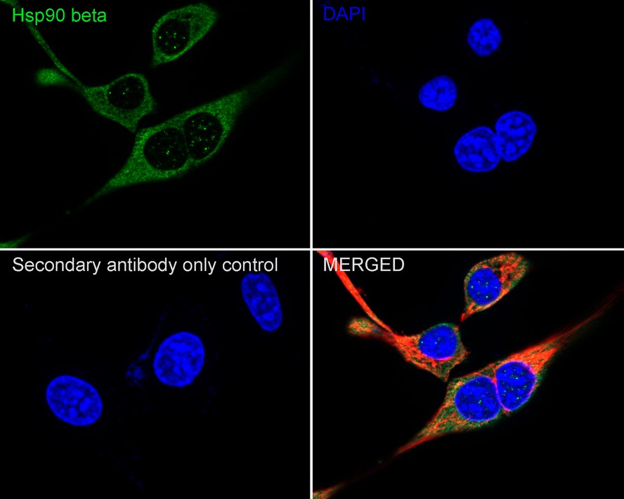 ICC staining of Hsp90 beta in Hela cells (green). Formalin fixed cells were permeabilized with 0.1% Triton X-100 in TBS for 10 minutes at room temperature and blocked with 1% Blocker BSA for 15 minutes at room temperature. Cells were probed with the primary antibody (ET1605-56, 1/50) for 1 hour at room temperature, washed with PBS. Alexa Fluor®488 Goat anti-Rabbit IgG was used as the secondary antibody at 1/1,000 dilution. The nuclear counter stain is DAPI (blue).