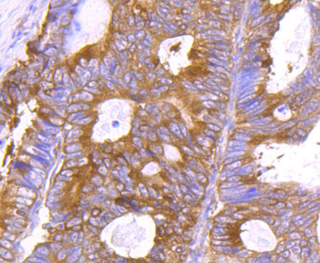 ICC staining of Hsp90 beta in NIH/3T3 cells (green). Formalin fixed cells were permeabilized with 0.1% Triton X-100 in TBS for 10 minutes at room temperature and blocked with 1% Blocker BSA for 15 minutes at room temperature. Cells were probed with the primary antibody (ET1605-56, 1/500) for 1 hour at room temperature, washed with PBS. Alexa Fluor®488 Goat anti-Rabbit IgG was used as the secondary antibody at 1/1,000 dilution. The nuclear counter stain is DAPI (blue).