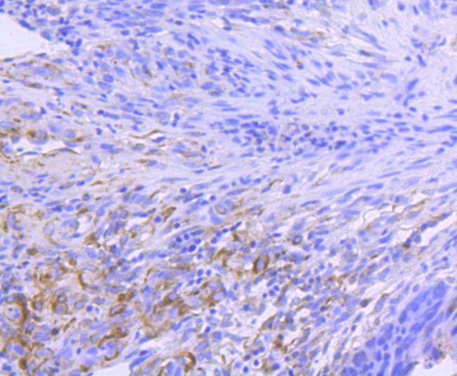 ICC staining of Hsp90 alpha in AGS cells (green). Formalin fixed cells were permeabilized with 0.1% Triton X-100 in TBS for 10 minutes at room temperature and blocked with 1% Blocker BSA for 15 minutes at room temperature. Cells were probed with the primary antibody (ET1605-57, 1/50) for 1 hour at room temperature, washed with PBS. Alexa Fluor®488 Goat anti-Rabbit IgG was used as the secondary antibody at 1/1,000 dilution. The nuclear counter stain is DAPI (blue).