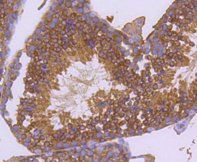 Immunohistochemical analysis of paraffin-embedded human tonsil tissue using anti-Hsp90 alpha antibody. The section was pre-treated using heat mediated antigen retrieval with Tris-EDTA buffer (pH 8.0-8.4) for 20 minutes.The tissues were blocked in 5% BSA for 30 minutes at room temperature, washed with ddH2O and PBS, and then probed with the primary antibody (ET1605-57, 1/50) for 30 minutes at room temperature. The detection was performed using an HRP conjugated compact polymer system. DAB was used as the chromogen. Tissues were counterstained with hematoxylin and mounted with DPX.