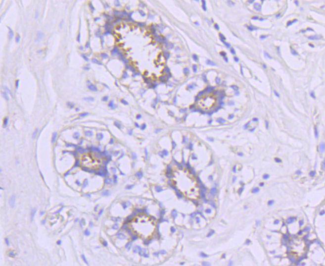 Immunohistochemical analysis of paraffin-embedded human breast tissue using anti-Hsp90 alpha antibody. The section was pre-treated using heat mediated antigen retrieval with Tris-EDTA buffer (pH 8.0-8.4) for 20 minutes.The tissues were blocked in 5% BSA for 30 minutes at room temperature, washed with ddH2O and PBS, and then probed with the primary antibody (ET1605-57, 1/50) for 30 minutes at room temperature. The detection was performed using an HRP conjugated compact polymer system. DAB was used as the chromogen. Tissues were counterstained with hematoxylin and mounted with DPX.