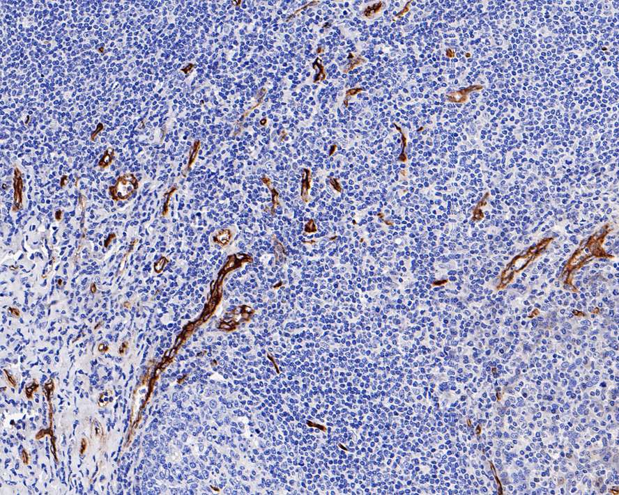 Immunohistochemical analysis of paraffin-embedded human kidney tissue with Rabbit anti-CD34 antibody (ET1606-11) at 1/1,000 dilution.<br />
<br />
The section was pre-treated using heat mediated antigen retrieval with Tris-EDTA buffer (pH 9.0) for 20 minutes. The tissues were blocked in 1% BSA for 20 minutes at room temperature, washed with ddH2O and PBS, and then probed with the primary antibody (ET1606-11) at 1/1,000 dilution for 1 hour at room temperature. The detection was performed using an HRP conjugated compact polymer system. DAB was used as the chromogen. Tissues were counterstained with hematoxylin and mounted with DPX.