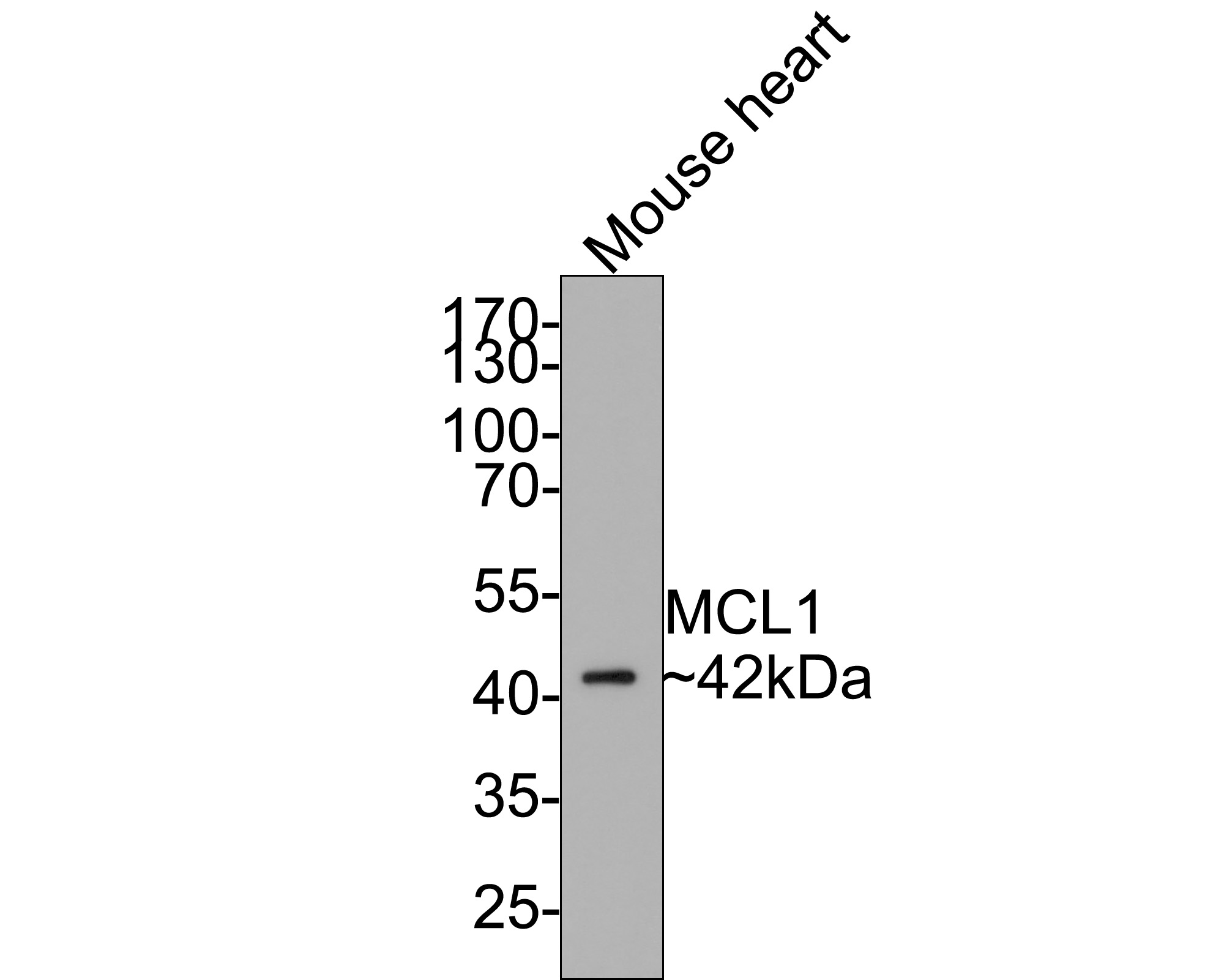 Western blot analysis of MCL1 on mouse heart tissue lysates with Rabbit anti-MCL1 antibody (ET1606-14) at 1/500 dilution.<br />
<br />
Lysates/proteins at 20 µg/Lane.<br />
<br />
Predicted band size: 37 kDa<br />
Observed band size: 42 kDa<br />
<br />
Exposure time: 2 minutes;<br />
<br />
10% SDS-PAGE gel.<br />
<br />
Proteins were transferred to a PVDF membrane and blocked with 5% NFDM/TBST for 1 hour at room temperature. The primary antibody (ET1606-14) at 1/500 dilution was used in 5% NFDM/TBST at room temperature for 2 hours. Goat Anti-Rabbit IgG - HRP Secondary Antibody (HA1001) at 1:300,000 dilution was used for 1 hour at room temperature.