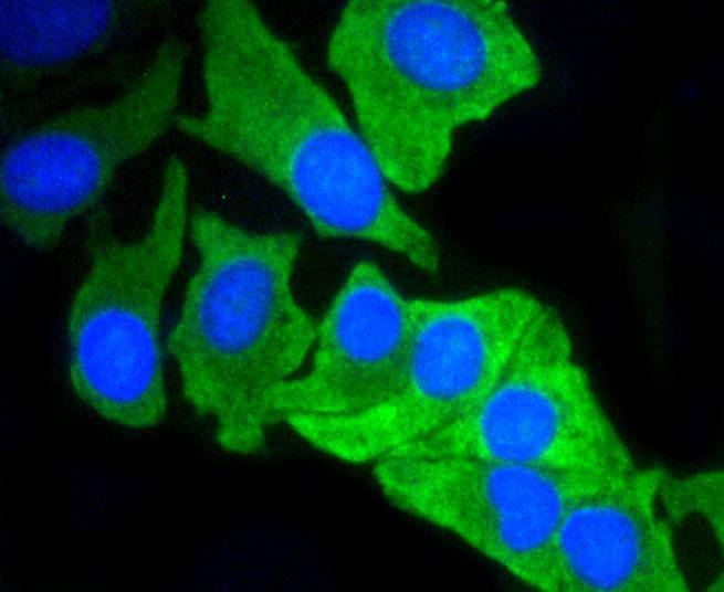 ICC staining of MCL1 in BT-20 cells (green). Formalin fixed cells were permeabilized with 0.1% Triton X-100 in TBS for 10 minutes at room temperature and blocked with 1% Blocker BSA for 15 minutes at room temperature. Cells were probed with the primary antibody (ET1606-14, 1/50) for 1 hour at room temperature, washed with PBS. Alexa Fluor®488 Goat anti-Rabbit IgG was used as the secondary antibody at 1/1,000 dilution. The nuclear counter stain is DAPI (blue).