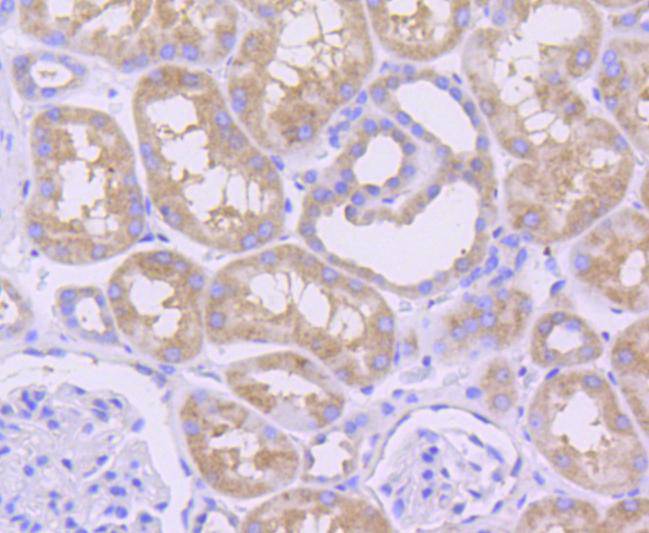 Immunohistochemical analysis of paraffin-embedded human kidney tissue using anti-MCL1 antibody. The section was pre-treated using heat mediated antigen retrieval with Tris-EDTA buffer (pH 8.0-8.4) for 20 minutes.The tissues were blocked in 5% BSA for 30 minutes at room temperature, washed with ddH2O and PBS, and then probed with the primary antibody (ET1606-14, 1/50) for 30 minutes at room temperature. The detection was performed using an HRP conjugated compact polymer system. DAB was used as the chromogen. Tissues were counterstained with hematoxylin and mounted with DPX.